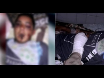 DENUNCIAN TENTATIVA DE HOMICIDIO EN CAMBYRETÁ