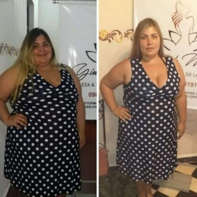 ¿La obesidad como arma para llamar la atención? El polémico caso de Pamelita Ovelar