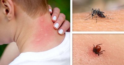 Recomendaciones para alérgicos ante picaduras de insectos