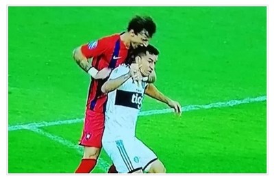 Camacho mordido en el clásico