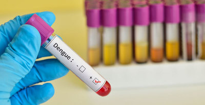 No existe una razón para declarar emergencia por dengue en Paraguay, afirma la OPS