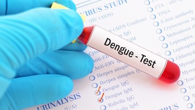 Ofrecen análisis de dengue en la facultad de Química de la UNA