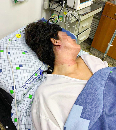 Imputan a un hombre por Tentativa de Feminicidio y Lesión Grave