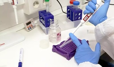 Hospital italiano prueba en pacientes con COVID fármacos contra malaria y VIH