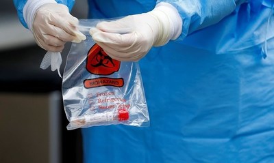 Coronavirus: 500.000 kits de prueba rápida llegan a Brasil, resultados en solo 15 minutos