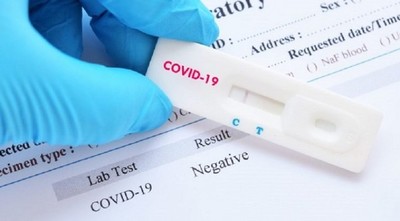 Un caso positivo de coronavirus en el Congreso Nacional