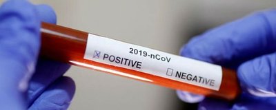 Un fármaco antiparasitario que se vende en todo el mundo podría eliminar al coronavirus en 48 horas